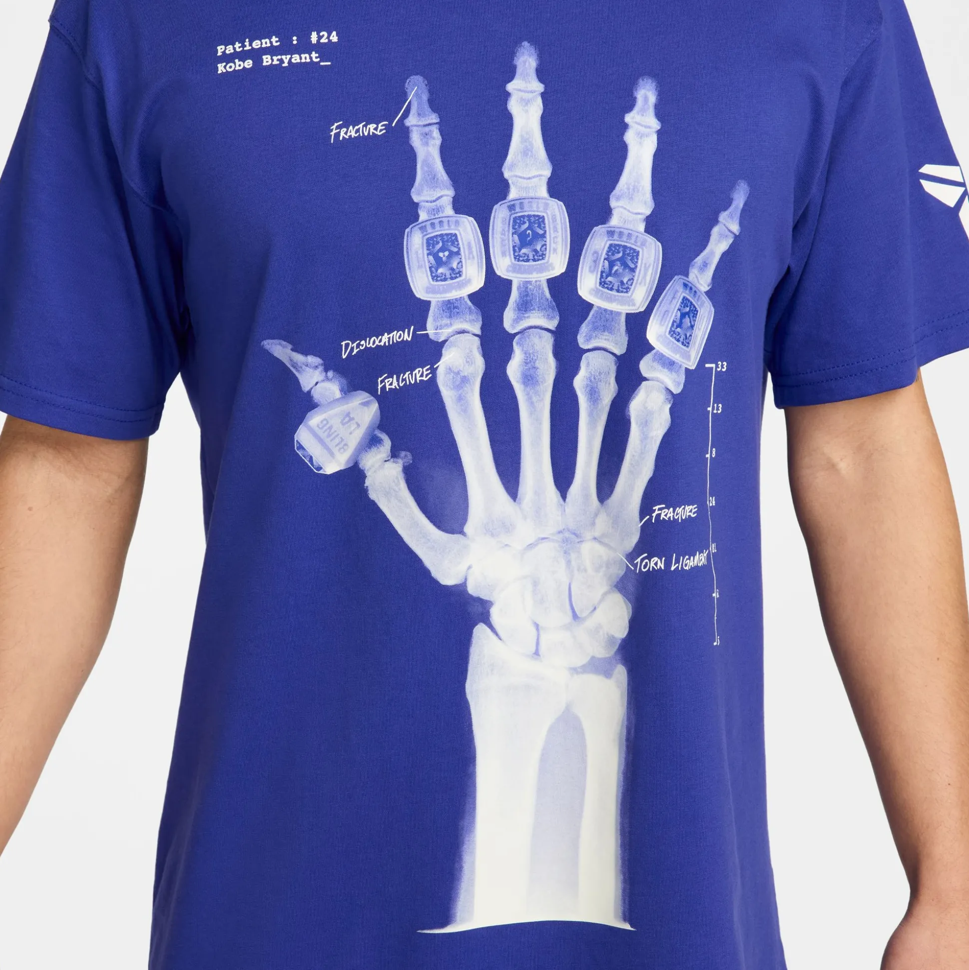 Kobe X-Ray Tee